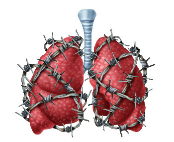 Астма у детей лечение без гормонов в Новосибирске